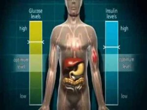 Diabetes Effects Animation